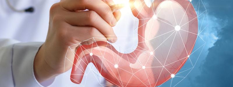 Schlauchmagen OP im Ausland